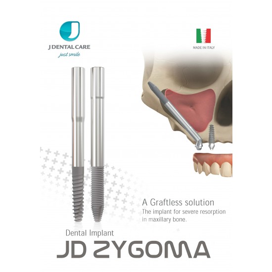 Implant JD Zygoma 3,9 x 30 mm titan grad 4
